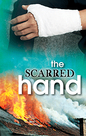 The Scarred Hand