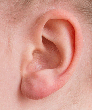 Ear