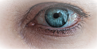 Eye